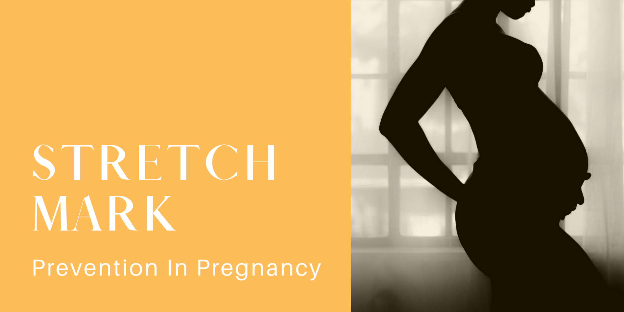 Stretch Mark Prevention in Pregnancy
